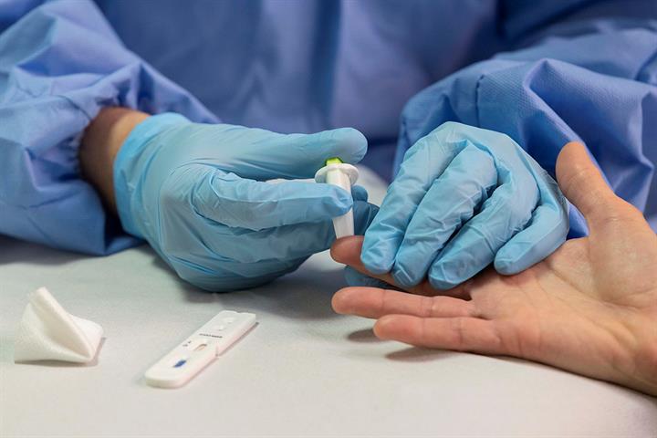 El CSIC crea un test que detecta la inmunidad al coronavirus con una fiabilidad del 98%